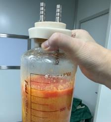 六盘水水动力吸脂手术要做多久？